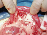 試験開腹で認められた膵臓の炎症